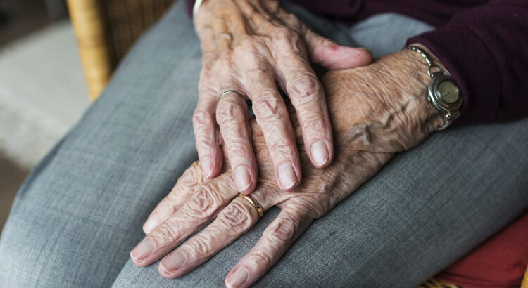 alzheimer